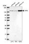 Valyl-TRNA Synthetase antibody, HPA046710, Atlas Antibodies, Western Blot image 