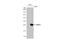 RAB7A, Member RAS Oncogene Family antibody, GTX130847, GeneTex, Western Blot image 