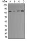 RB Transcriptional Corepressor 1 antibody, orb338938, Biorbyt, Western Blot image 
