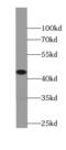 Sia-alpha-2,3-Gal-beta-1,4-GlcNAc-R:alpha 2,8-sialyltransferase antibody, FNab08277, FineTest, Western Blot image 
