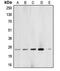 BCAS2 Pre-MRNA Processing Factor antibody, LS-C353244, Lifespan Biosciences, Western Blot image 