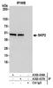 S-phase kinase-associated protein 2 antibody, A302-436A, Bethyl Labs, Immunoprecipitation image 