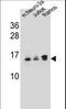 Ubiquitin Conjugating Enzyme E2 E2 antibody, LS-C160379, Lifespan Biosciences, Western Blot image 