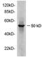 AP-2 complex subunit mu antibody, LS-C203060, Lifespan Biosciences, Western Blot image 