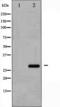 Cyclin Dependent Kinase Inhibitor 1B antibody, TA325352, Origene, Western Blot image 