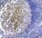 Polo Like Kinase 2 antibody, A02881, Boster Biological Technology, Immunohistochemistry paraffin image 