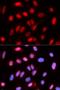 Replication Factor C Subunit 4 antibody, LS-C334086, Lifespan Biosciences, Immunofluorescence image 