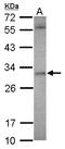 Ankyrin Repeat And SOCS Box Containing 12 antibody, LS-C155632, Lifespan Biosciences, Western Blot image 
