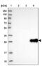 UTP11 Small Subunit Processome Component antibody, NBP1-92567, Novus Biologicals, Western Blot image 