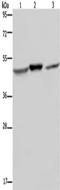NADH dehydrogenase [ubiquinone] iron-sulfur protein 2, mitochondrial antibody, TA351433, Origene, Western Blot image 