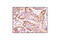 Catenin Beta 1 antibody, 9587S, Cell Signaling Technology, Immunohistochemistry paraffin image 