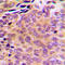 Aldo-Keto Reductase Family 1 Member E2 antibody, GTX54889, GeneTex, Immunohistochemistry paraffin image 