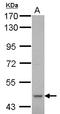 CYP51A1 antibody, LS-C155291, Lifespan Biosciences, Western Blot image 