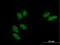 SSU72 Homolog, RNA Polymerase II CTD Phosphatase antibody, H00029101-B01P, Novus Biologicals, Immunocytochemistry image 