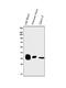Aldo-Keto Reductase Family 1 Member D1 antibody, A05278-2, Boster Biological Technology, Western Blot image 
