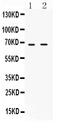 Baculoviral IAP Repeat Containing 3 antibody, PB9527, Boster Biological Technology, Western Blot image 