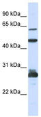 Pescadillo homolog antibody, TA334509, Origene, Western Blot image 