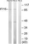 Gamma-interferon-inducible protein 16 antibody, LS-C119992, Lifespan Biosciences, Western Blot image 