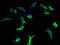 Lipopolysaccharide-responsive and beige-like anchor protein antibody, A52764-100, Epigentek, Immunofluorescence image 