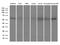Inducible T Cell Costimulator Ligand antibody, M01965, Boster Biological Technology, Western Blot image 