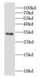 F-actin-capping protein subunit alpha-1 antibody, FNab01256, FineTest, Western Blot image 