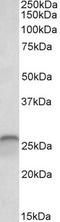 Calbindin 1 antibody, TA311315, Origene, Western Blot image 
