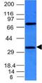 Fascin Actin-Bundling Protein 1 antibody, orb388663, Biorbyt, Western Blot image 