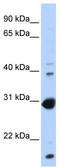Nuclear Receptor Subfamily 0 Group B Member 2 antibody, TA339536, Origene, Western Blot image 