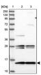 Ubiquinol-Cytochrome C Reductase Complex Assembly Factor 2 antibody, PA5-58659, Invitrogen Antibodies, Western Blot image 