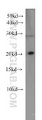 RB Binding Protein 9, Serine Hydrolase antibody, 66015-2-Ig, Proteintech Group, Western Blot image 