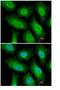 Fanconi anemia group A protein antibody, ab97578, Abcam, Immunofluorescence image 