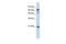 Germinal Center Associated Signaling And Motility antibody, PA5-44375, Invitrogen Antibodies, Western Blot image 