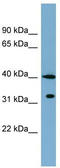 BTB/POZ domain-containing protein KCTD9 antibody, TA344984, Origene, Western Blot image 