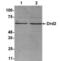 Dopamine Receptor D2 antibody, 54-342, ProSci, Western Blot image 
