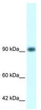 RNA Binding Motif Protein 10 antibody, TA329114, Origene, Western Blot image 