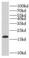 P2 antibody, FNab06575, FineTest, Western Blot image 