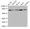 ATP Binding Cassette Subfamily B Member 9 antibody, LS-C502060, Lifespan Biosciences, Western Blot image 
