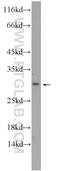 MAGI Family Member, X-Linked antibody, 24518-1-AP, Proteintech Group, Western Blot image 