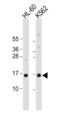 Small nuclear ribonucleoprotein Sm D1 antibody, MBS9201530, MyBioSource, Western Blot image 