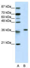 60S ribosomal protein L6 antibody, TA345687, Origene, Western Blot image 