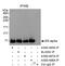 Estrogen Receptor 1 antibody, A300-495A, Bethyl Labs, Immunoprecipitation image 