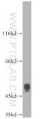 X-Linked Inhibitor Of Apoptosis antibody, 10037-1-Ig, Proteintech Group, Western Blot image 