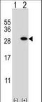 Glutathione S-Transferase Theta 1 antibody, LS-C166717, Lifespan Biosciences, Western Blot image 