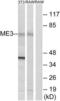 NADP-dependent malic enzyme, mitochondrial antibody, LS-C120132, Lifespan Biosciences, Western Blot image 