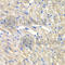 Cysteinyl-tRNA synthetase, cytoplasmic antibody, A6540, ABclonal Technology, Immunohistochemistry paraffin image 