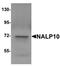 NLR Family Pyrin Domain Containing 10 antibody, orb75490, Biorbyt, Western Blot image 