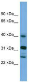 Periphilin 1 antibody, TA344584, Origene, Western Blot image 