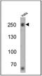 Spectrin Beta, Erythrocytic antibody, MA3-062, Invitrogen Antibodies, Western Blot image 