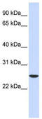 Ubiquitin Conjugating Enzyme E2 K antibody, TA344492, Origene, Western Blot image 
