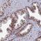 Netrin receptor UNC5D antibody, PA5-60168, Invitrogen Antibodies, Immunohistochemistry frozen image 